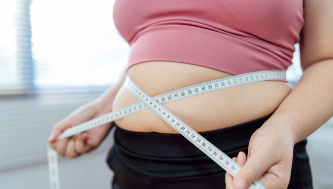 obesità e chirurgia bariatrica